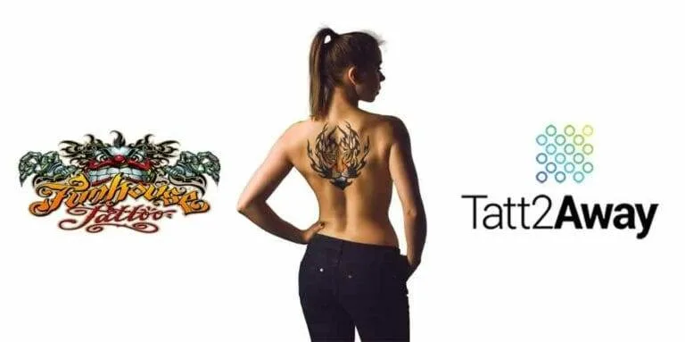 A woman with a tattoo undergoes Tattoo Removal Done Differently with a tattoo2away logo.