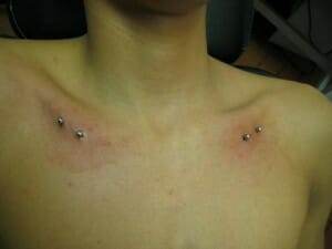 picture of body surface piercing