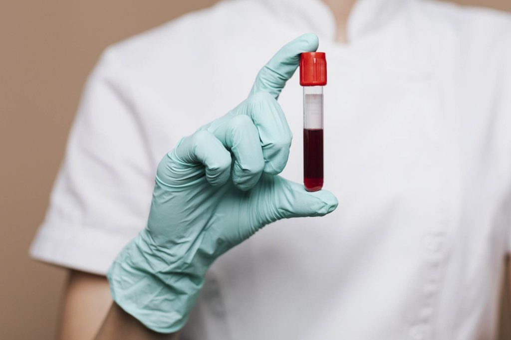 A person wearing green gloves holds up a test tube containing a red liquid, possibly blood, hinting at the impact and importance of donating blood.